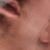 thumb2